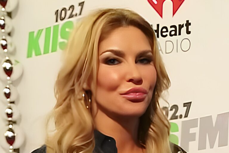 Americká televizní hvězda zveřejnila svou znetvořenu tvář. Na vině je parazit nebo stres. Fanoušci zmiňují i botox