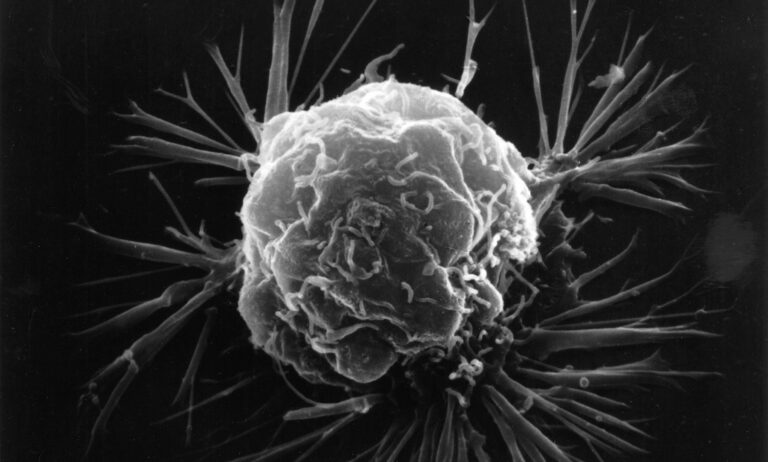 Vědci hlásí 99% úspěšnost: Revoluční metoda likviduje rakovinné buňky bleskovou rychlostí