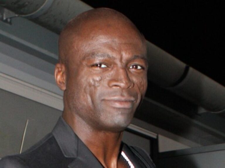 Seal: Holá hlava a jizvy na tváři kvůli vzácnému onemocnění. Za manželku měl jednu z nejkrásnějších žen na světě