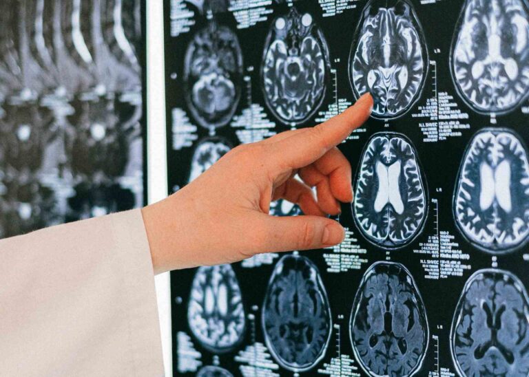 Náš mozek začíná chřadnout už po čtyřicítce. Věda zná viníka i možnou záchranu