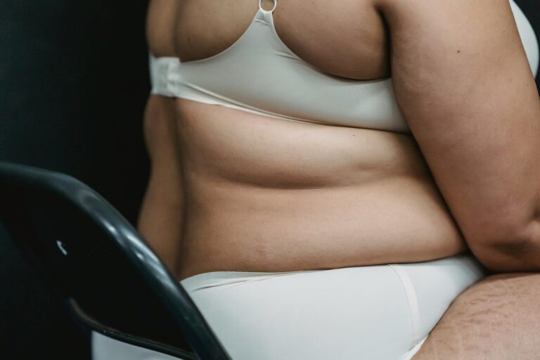 Ženy se po porodu stydí za něco, co je naprosto přirozené: Až 90 % z nich trápí strie, převisy kůže i bolestivá břicha