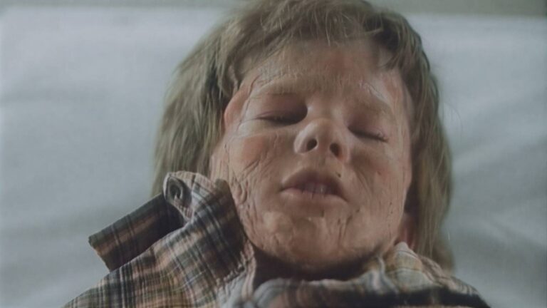 Cena medu: Útok pěti set včel, živý hmyz na tváři sedmiletého chlapce a skrytý vtip o Nemocnici na kraji města